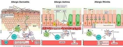 IJMS | Special Issue : Molecular Mechanisms and Treatment of Allergic ...