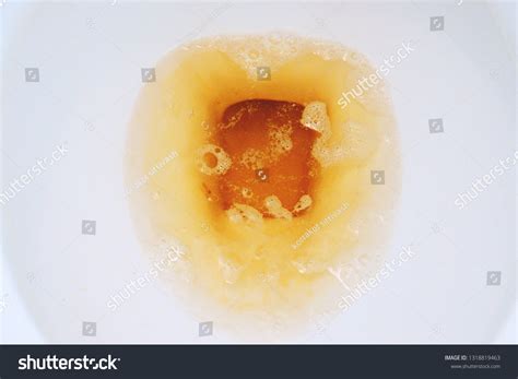 Closeup Urine Yellow Pee Bubbles White Stock Photo 1318819463 ...