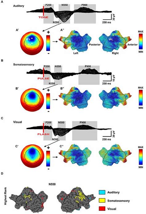 K-Complex 的图像结果