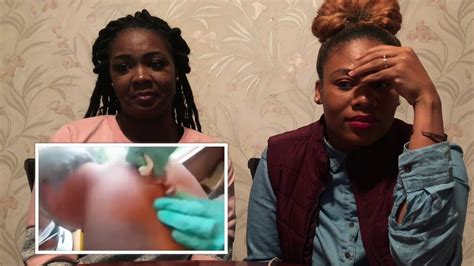 Image result for Big Cysts Exploding