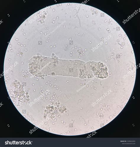 Board Waxy Cast Urine Stock Photo 1939652455 | Shutterstock