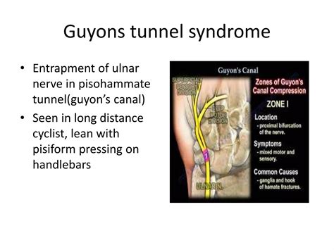 Radial, ulnar and median nerve injuries | PPTX