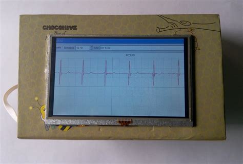 Steps for Using an ECG Machine 的图像结果