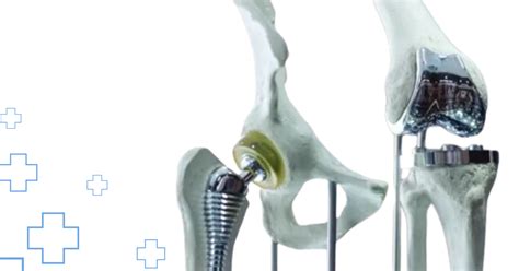 Invent 的图像结果