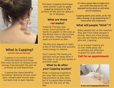 Image result for Cupping Tutorial