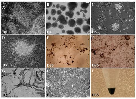 Highly Effective Protocol for Differentiation of Induced Pluripotent ...