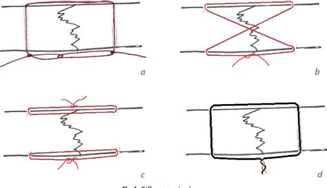 Image result for Transnasal Loop Fixation