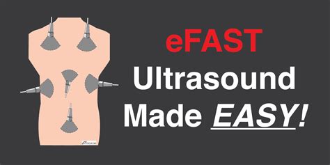 FAST Scan-eFAST Ultrasound Exam Made Easy: Step-By-Step Guide - POCUS 101