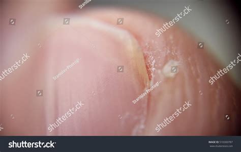 Image result for Finger Under Microscope