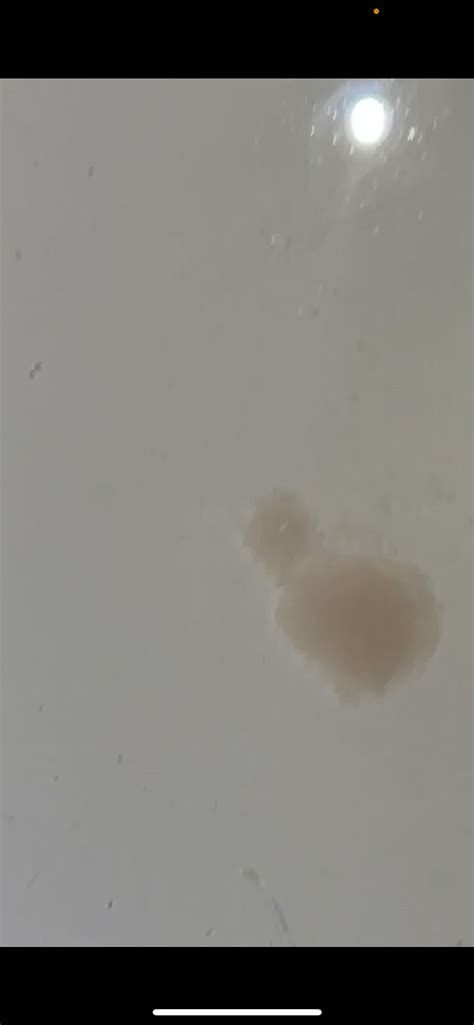 Possible implantation discharge? TMI!! | BabyCenter