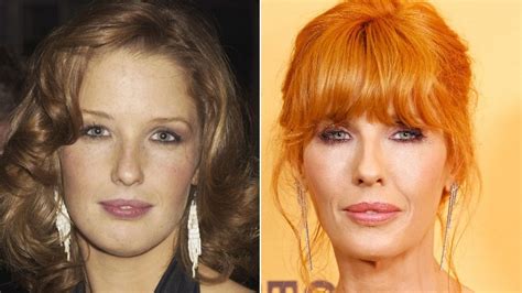 Did Yellowstone's Kelly Reilly Get Plastic Surgery? Here's What She's Said