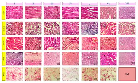 Injectable In-Situ Forming Depot Based on PLGA and PLGA-PEG-PLGA for ...