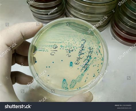 Pseudomonas Fluorescens Broth