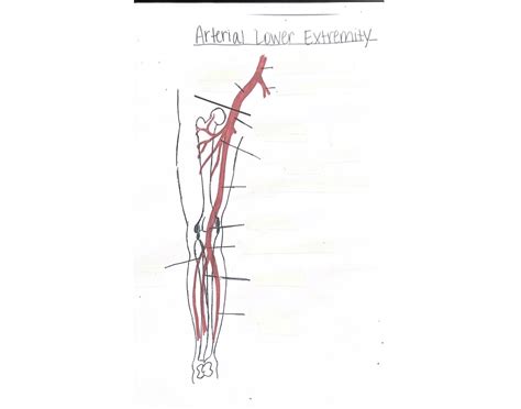 DMS 255: Arterial Lower Extremity Quiz