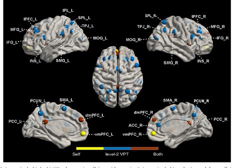 Image result for Visuospatial Function