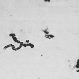 Acetobacter Isolation Process Image 的图像结果