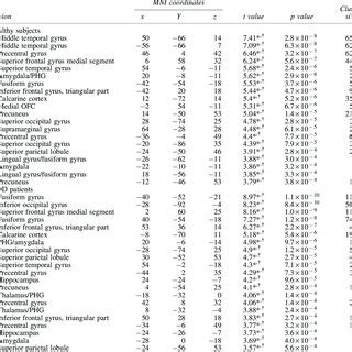 Statistical Parametric Mapping 的图像结果
