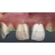 AR Dentistry Mirrors : cosmetic dentistry aid
