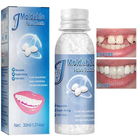 Tooth Repair Kit DIY Fake Teeth Repair Beads for Temporary Fixing Tooth ...