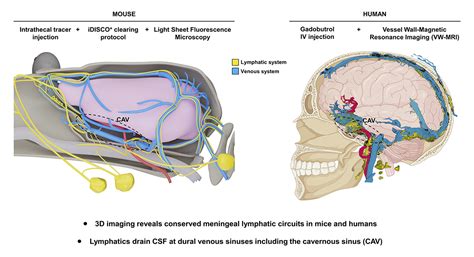 Image result for Intrathecal Injection Mouse