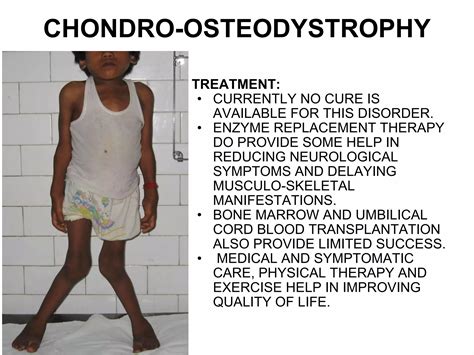 Morquio syndrome | PPT