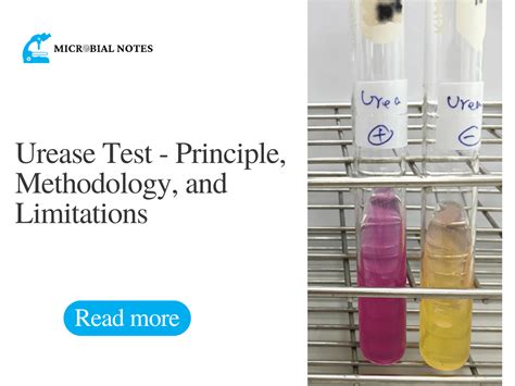 Image result for Urease Pronounce