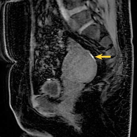 ISMRM 2025 abstracts