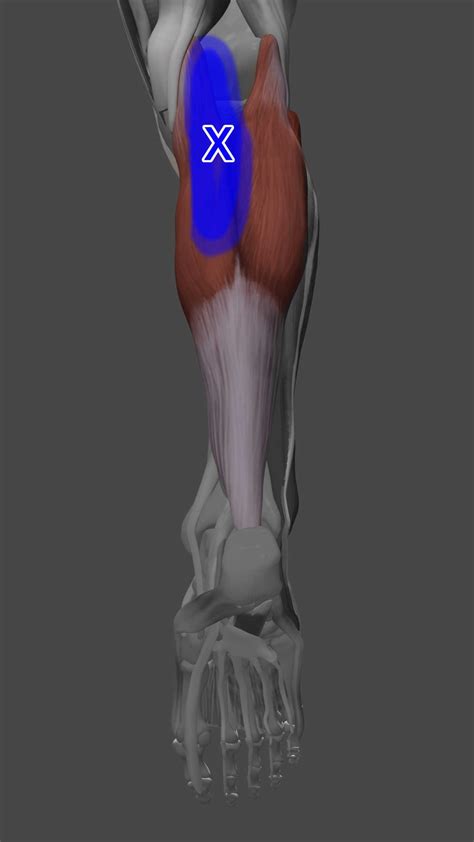 Acupuncture for Calf Trigger Points — Morningside Acupuncture NYC