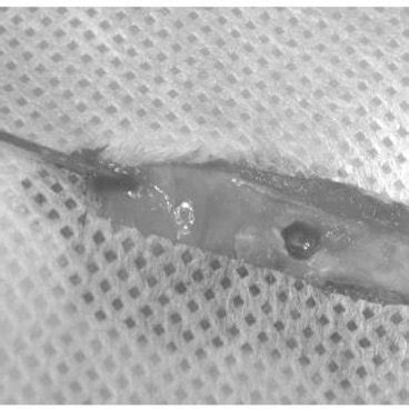 Image result for Undulation Defect