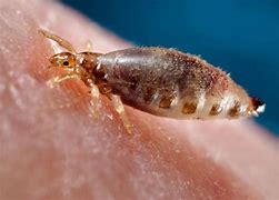 Image result for typhus
