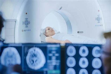 TDM Scanner 的图像结果