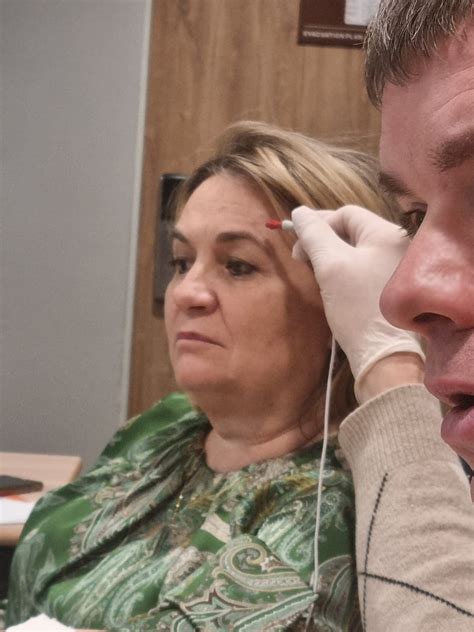 Image result for Single Fiber EMG Test