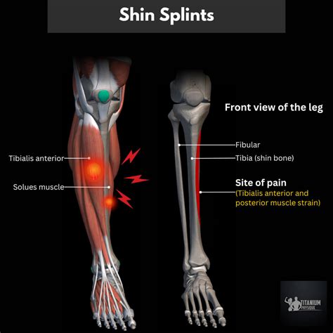 Leg Pain and Foot Tendonitis | Root Causes & Relief Exercise