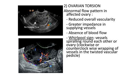 PPT - Ultrasound in gynaecology PowerPoint Presentation, free download - ID:9105511