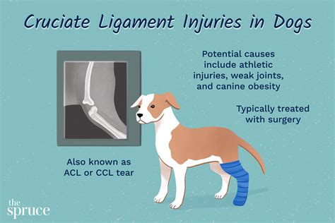 Anatomy Of Anterior Cruciate Ligament