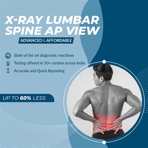 X-ray Lumbar Spine AP view - Aarthi Scans and Labs