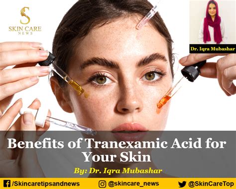 Benefits of Tranexamic Acid for Your Skin - Skincare Top News