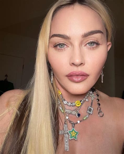 Plastic surgery experts on the work Madonna did to her face