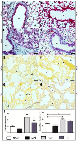 Enhanced Vulnerability of Diabetic Mice to Hypervirulent Streptococcus ...