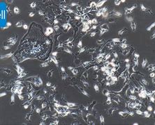 Image result for 破骨细胞
