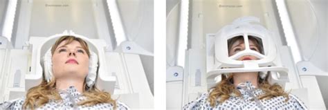 Aliasing CSF Flow MRI 的图像结果