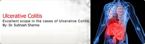 Homeopathic Treatment For Ulcerative Colitis | Homeopathy For ...