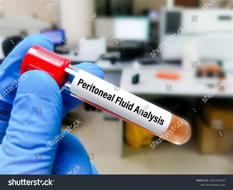 Body Fluids Analysis 的图像结果