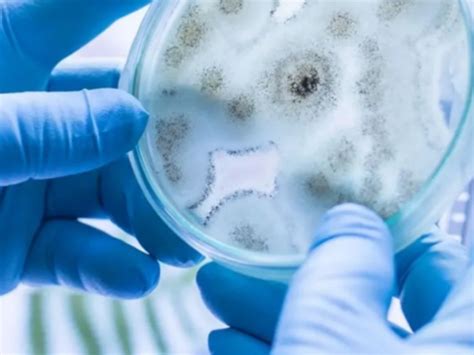 澳洲印象-这国首次出现“超级真菌”感染病例！