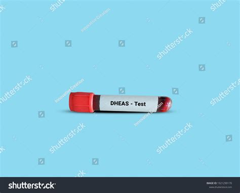 26 imágenes de Dhea test - Imágenes, fotos y vectores de stock | Shutterstock