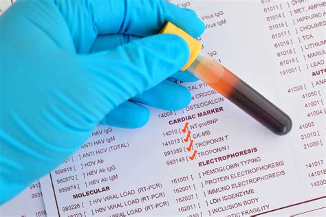 Understanding the hs-CRP Blood Test and Related Factors