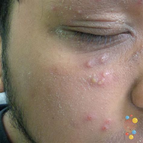 Welcome to Skin Deep - Skin Deep