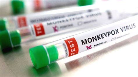 Monkeypox confirmed to 31-year old woman in Delhi, total 9 cases in ...