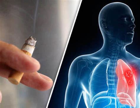 The impact of smoking on cardiovascular health – 2baconil