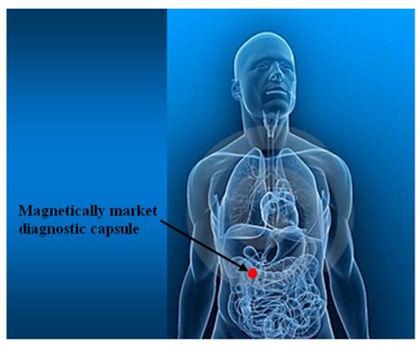 Resonant Magnetic Field Sensors Based On MEMS Technology